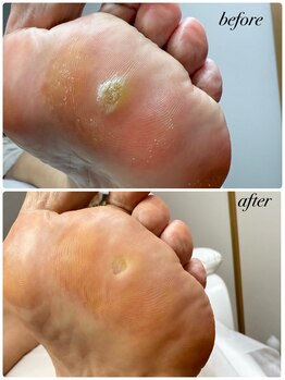 ラヴィ(La vie)/魚の目ではないの？