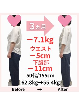 おもいやり鍼灸治療院 モーイ(mooi)/鍼灸痩身ダイエット