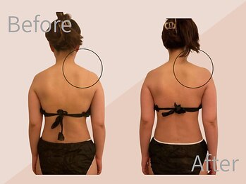 ファミーユ 名古屋店/【ブライダルエステ】ドレスケア