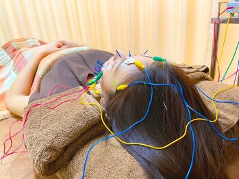 おぐの和の写真/【美容鍼×肌育】女性鍼灸師による肌質改善◎肌の深部までアプローチ☆1日1名限定のお得なsetクーポン有♪