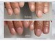 エトレ 大垣(Et-Re:)の写真/爪が薄い、巻き爪に悩んでる…そんなお悩みをお持ちの方に◎丁寧なカウンセリングでお悩みを解決します♪