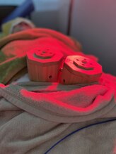 タイチ鍼灸接骨院/お灸中の雰囲気です