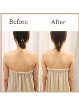 サロンルーチェ(Salon Luce)/ビフォーアフター/施術回数1回