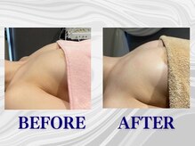 ザモア 福岡天神(THE MORE)/【症例 Before After】