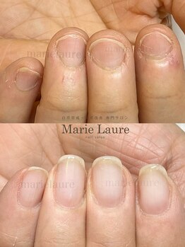 マリーロール 梅田店(Marie Laure)/深爪矯正/自爪育成/ネイルケア