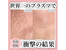 エミュローズ 段原店(Nm' Rose)