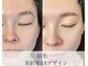 ダブリューアイキャンディー(W eye candy)の写真