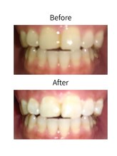 ニコ 西葛西店(nico)/ビフォーアフター