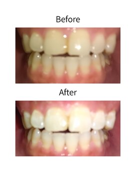 ニコ 西葛西店(nico)/ビフォーアフター