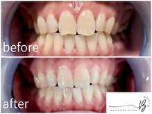 ビューティーラボ(Beauty Lab.)/before→after