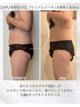 ヨサパーク ユアン(YOSA PARK yuann)/20代/太る体質だと諦めていた方