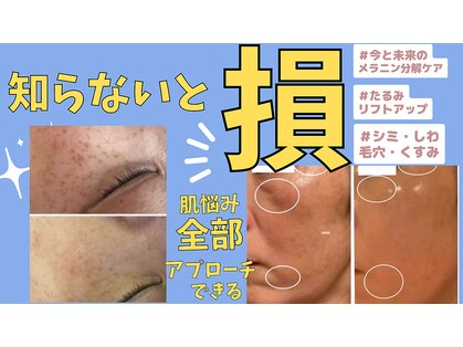 ミライ(Mirai)の写真
