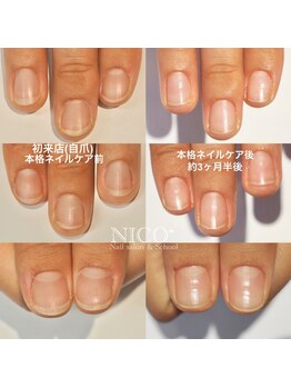 ニコプラス(NICO+)/爪育ネイルケア