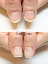 マリーロール 梅田店(Marie Laure)/自爪育成/深爪矯正/ネイルケア
