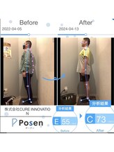 クレコ蕨整体院 東口駅前店(CURECO蕨整体院)/実際の変化【整体/姿勢矯正】