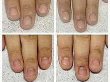 グレースレディ/凹みも改善