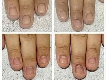 グレースレディ/凹みも改善