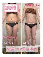 サロン ド フェイス モアナ(Salon de Faith Moana)/キャビテーション痩身【20代】