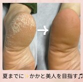 マハロミ(mahalomi)
