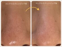 グランボヌール(grand bonheur)/【エレクトロクレンジング】