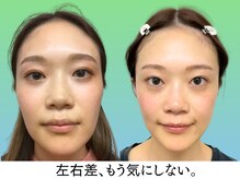 ナチュラルビューティーフェイス 横浜(NBF)