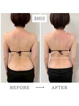 ビューイング(美ing)/恥ずかしくない後ろ姿に！