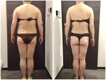 ウェリナ平和堂長久手院/小顔矯正/骨盤矯正/美脚サロン