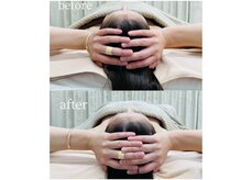 アファン 鶴見店(Afun)/小顔BeforeAfter［横浜/たるみ］