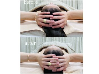 アファン 鶴見店(Afun)/小顔BeforeAfter［横浜/たるみ］