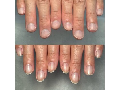 カラー(calla)の写真