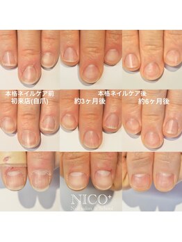 ニコプラス(NICO+)/爪育ネイルケア