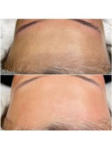 ヘアアンドメイク ボンアミ(HAIR & MAKE Bon ami)/フェイシャルワックス