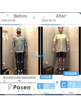 クレコ蕨整体院 東口駅前店(CURECO蕨整体院)/実際の変化【整体/姿勢矯正】