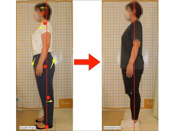 リファイン(Refine)/お尻を突き出し前屈みの姿勢改善