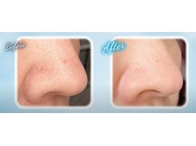 ケイココ(Keicoco)/