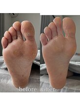 フットミー(foot mii)/