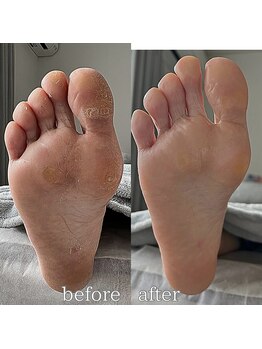 フットミー(foot mii)/