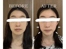 ヨサパーク アーバンヘブン 目黒(YOSA PARK Urban Heaven)/短期期間で集中ダイエット！