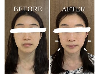 ヨサパーク アーバンヘブン 目黒(YOSA PARK Urban Heaven)/短期期間で集中ダイエット!