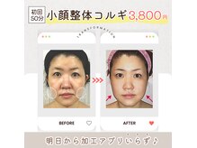 小顔整体研究所 KSラボ 江坂店の雰囲気（【小顔整体コルギ】は痛気持ちが良いと皆様おっしゃられます♪）