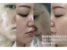 サロン ド エメ(salon de aimer)の雰囲気（長年の肌悩み、沢山の美容施術経験からお伝えできる事があります）