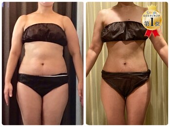 美容整体ウェリナ あま甚目寺院/小顔矯正/骨盤矯正/美脚サロン