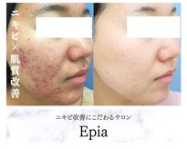 エピア 西尾店(Epia)