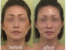 サロンハート(Salon Heart)/