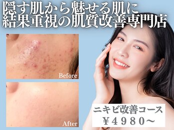 アクール(Accueil)