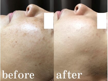 ブランピュールの写真