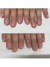 リコリサイア(ricco risaia)/長年お悩みだった深爪から美爪へ