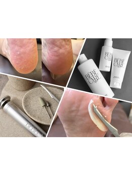 角質ケアができるサロン