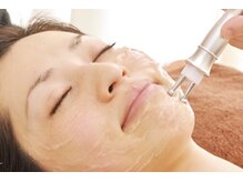 ベルーチェ(Beluce)/リフトアップ