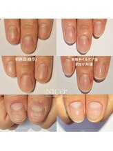 ニコプラス(NICO+)/爪育ネイルケア